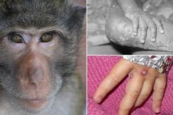 Long An phát hiện ca đậu mùa khỉ đầu tiên