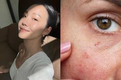 Kem chống nắng: Dùng đúng cách để chống già