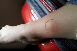 Những dấu hiệu ở chân cho thấy tế bào ung thư bắt đầu 'làm loạn', không khám nhanh thì khó cứu vãn