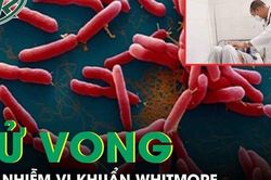Một người ở Quảng Nam tử vong do nhiễm vi khuẩn Whitmore