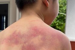 Tạm giữ người cha liên tục bạo hành con trai 5 tuổi