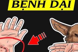 Đề xuất 8 bệnh truyền nhiễm nhóm B được ưu tiên bố trí ngân sách cho hoạt động khám, chữa bệnh