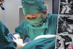 Nối thành công cẳng chân cho bệnh nhân bị chém gần đứt lìa và sốc mất máu