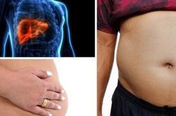 6 dấu hiệu cảnh báo bệnh ung thư gan rất nhiều người bỏ sót, sợ nhất là cái thứ 4 ai cũng coi thường