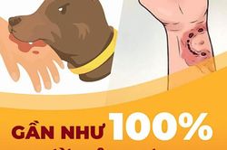 Nhiều trẻ bị chó cắn đa vết thương toàn thân