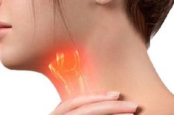 Viêm thanh quản khi nào cần đi khám?