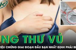 8 triệu chứng ung thư vú giai đoạn đầu bạn đã biết?
