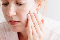 Bị bệnh chàm, chăm da thế nào cho đẹp?