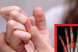 3 thói quen tưởng vô hại nhưng âm thầm 'tự đầu độc' xương khớp - bỏ càng sớm càng tốt