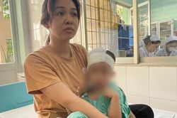 Ngã cầu thang, bé 4 tuổi có khối máu tụ to bằng quả cam trong não
