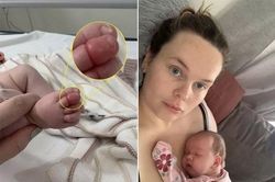 Em bé sơ sinh suýt mất ngón chân chỉ vì sợi tóc của mẹ