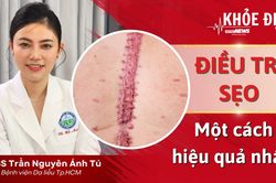 Khỏe đẹp 24h: Cách điều trị sẹo xấu hiệu quả nhất