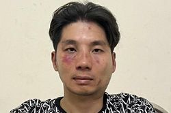 Lời khai bất nhất của thanh niên đâm trung tá công an ở Hà Nội nhập viện