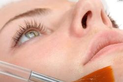 Làm đẹp bằng sản phẩm chứa axit, người phụ nữ nhập viện vì bị biến dạng dung mạo