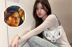 Nữ diễn viên tái phát bệnh cũ trên da gây lo lắng, là nguyên nhân của việc liên tục tăng cân