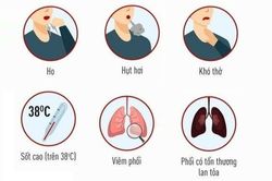 Liên tiếp phát hiện các ca viêm phổi cộng đồng, bác sĩ khuyến cáo