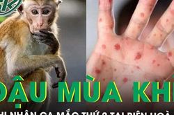 Đồng Nai ghi nhận ca mắc đậu mùa khỉ thứ 2 tại Biên Hòa