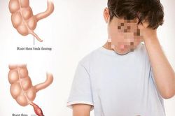 Nhập viện muộn, 2 trẻ suýt nguy kịch vì viêm ruột thừa vỡ