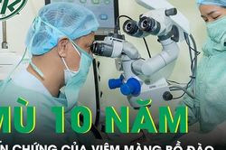 10 năm không thể nhìn thấy ánh sáng do biến chứng của viêm màng bồ đào