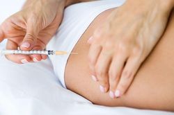 Người phụ nữ trẻ gặp họa sau 4 năm tiêm filler làm căng vòng 3