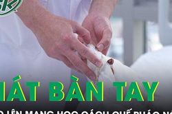 Dập nát bàn tay do lên mạng học chế pháo nổ