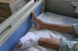 Biến chứng loét chân ở bệnh nhân đái tháo đường