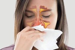 Các loại viêm xoang thường gặp và triệu chứng