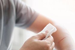 5 biện pháp giúp cầm máu nhanh chóng ngay tại nhà, ai cũng cần phải biết