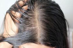 Tóc bết da dầu làm thế nào khắc phục?