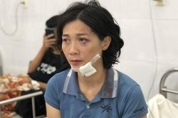 Đà Nẵng: Nạn nhân bàng hoàng kể lại phút giây kinh hoàng xe khách lao xuống vực