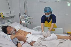 Thêm trường hợp đa chấn thương nặng do pháo nổ