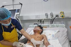 Đà Nẵng: Một thiếu niên bị chấn thương nặng do chơi pháo phát nổ