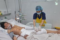 Bé trai 12 tuổi bị thượng nặng do đốt pháo
