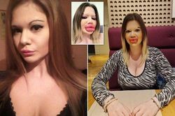 Cô gái có đôi môi lớn nhất thế giới muốn bán đấu giá những nụ hôn