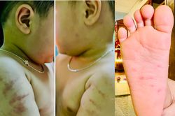 Xác minh thông tin 2 trẻ bị bạo hành tại cơ sở mầm non tư thục ở Bình Định