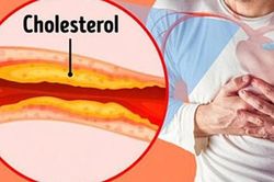 4 loại thực phẩm tốt nhất giúp giảm mức cholesterol