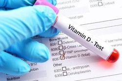 Cách ngăn ngừa tình trạng thiếu vitamin D ở trẻ em