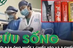 Cứu sống người đàn ông nuốt 1 chiếc kéo và 3 chiếc bật lửa vào bụng