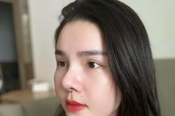 Kỳ Hân - vợ Mạc Hồng Quân khoe mũi sau phẫu thuật thẩm mỹ nhưng dân tình lại khen mũi cũ đẹp hơn