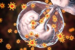 Rubella: Nguyên nhân, triệu chứng, đường lây truyền, cách điều trị và phòng bệnh