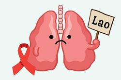 Quyết tâm chấm dứt bệnh lao