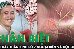Cách phân biệt liệt dây thần kinh số 7 ngoại biên và đột quỵ