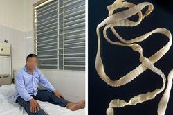 Sán dây dài 10m trong cơ thể người đàn ông