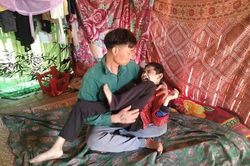 Cha đơn thân bất lực khi con trai bị bại não bẩm sinh