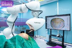 Cấy tóc tự động hoàn toàn bằng công nghệ ARTAS IXi có những gì?