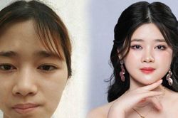 'Cô gái mặt lõm' sống trong mặc cảm, 'lột xác' ngoạn mục khiến cả làng bất ngờ