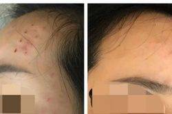 Nhầm lẫn tai hại trong tiệm spa