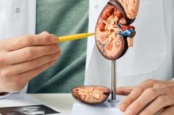 5 chất bổ sung có thể gây hại cho thận