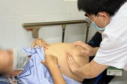 Nghiện ăn rau muống sống, người đàn ông mang ổ sán lớn ở gan