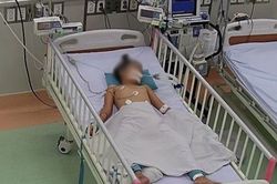 Bé gái 11 tuổi phải thở máy vì bị rắn hổ đất cắn